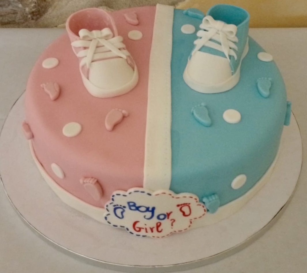 Torta Gender Reveal Rosa Azzurra Scarpette Boy Or Girl